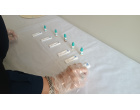اجرای طرح غربالگری سرطان کولون (روده بزرگ) به همت اداره بهداشت و درمان دانشگاه